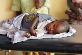 MALNUTRITION À BOUREM : DES RISQUES D’AGGRAVATION SI RIEN N’EST FAIT URGEMMENT.